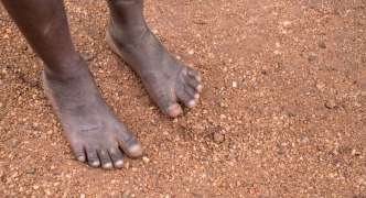 Poverty Child Feet in Africa