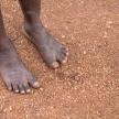 Poverty Child Feet in Africa