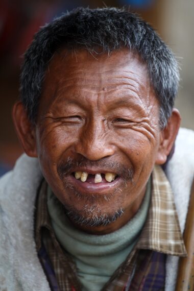 CHIN STATE, MYANMAR - JUNE 18 2015: Local weathered faced man with missing teeth in the recently opened for tourists Chin State Mountainous Region, Myanmar (Burma)